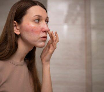 skin problems in winter and how spa treatments at the best spa in kolkata can solve them